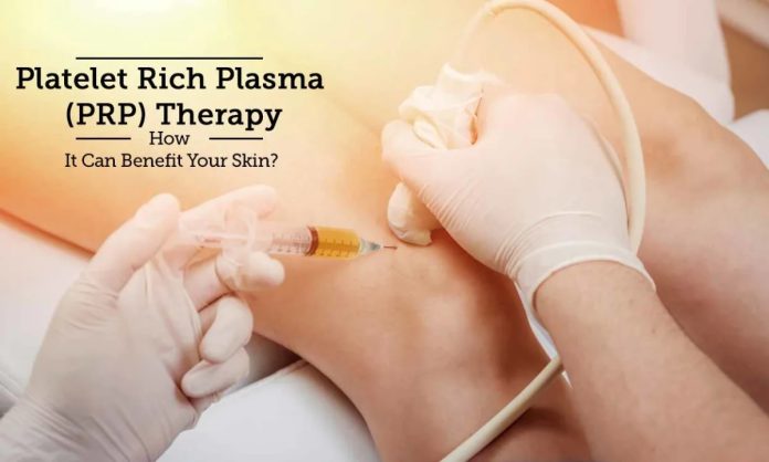 Platelet Rich Plasma Therapy Scottsdale