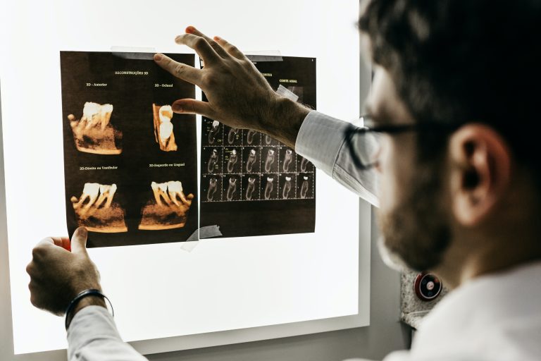 <strong>Significant Tips in Selecting the Best X-ray Clinic</strong>