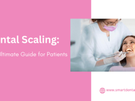 Dental Scaling: The Ultimate Guide for Patients