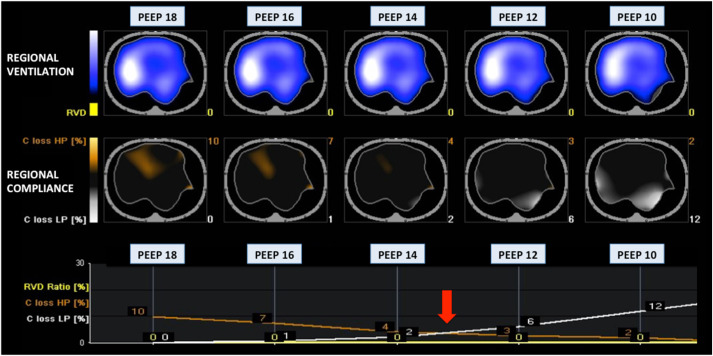 Clinical Studies Using Electrical Impedance Tomography: Insights and Findings