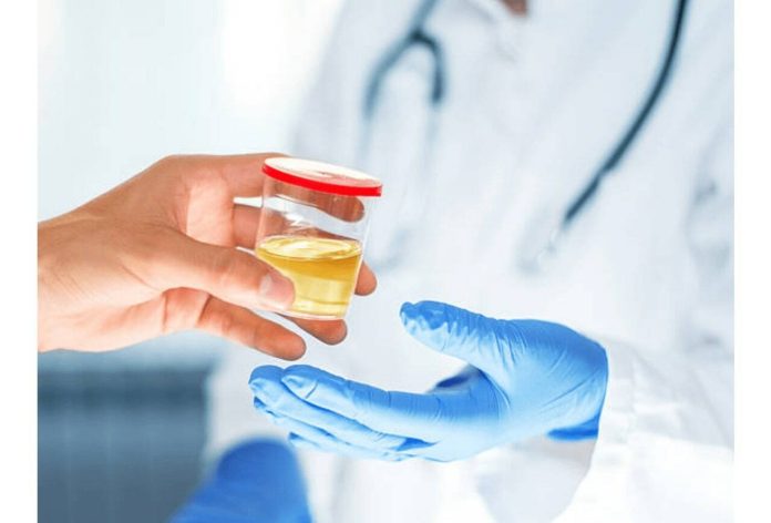 Urine Warming Device