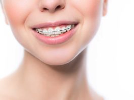 menifee orthodontics