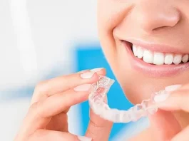 teeth aligners