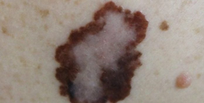 dermatologist Orange CA