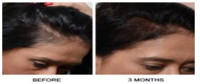 hair loss doctor New Jersey